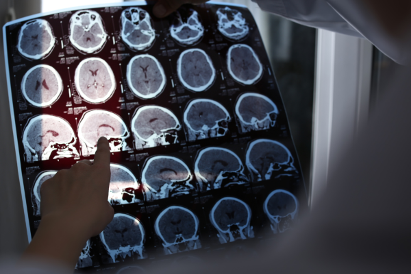 Translational Neuroimmunology and Stroke Research Group