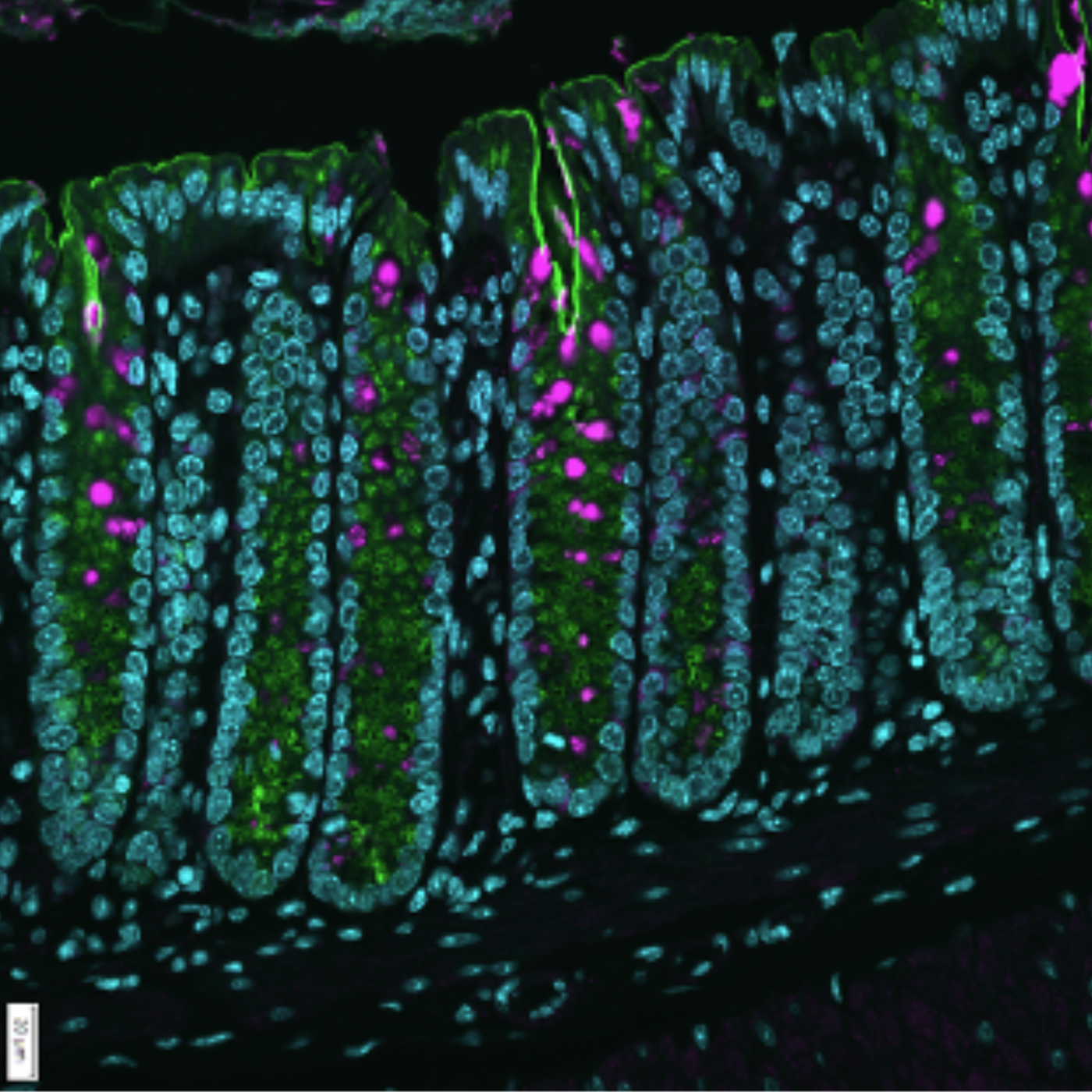 Patient-derived intestinal organoids